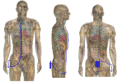 Abbildung 4: Eines der Szenarien mit einem am Körper befestigten drahtlosen Mikrofon (body-pack).