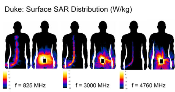 Abbildung 7: Die spezifischen Absorptionsraten für am Körper getragene drahtlose Mikrofone.